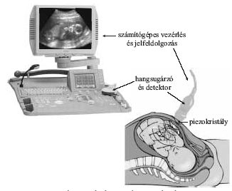 1. bra. Az ultrahangos diagnosztika elve